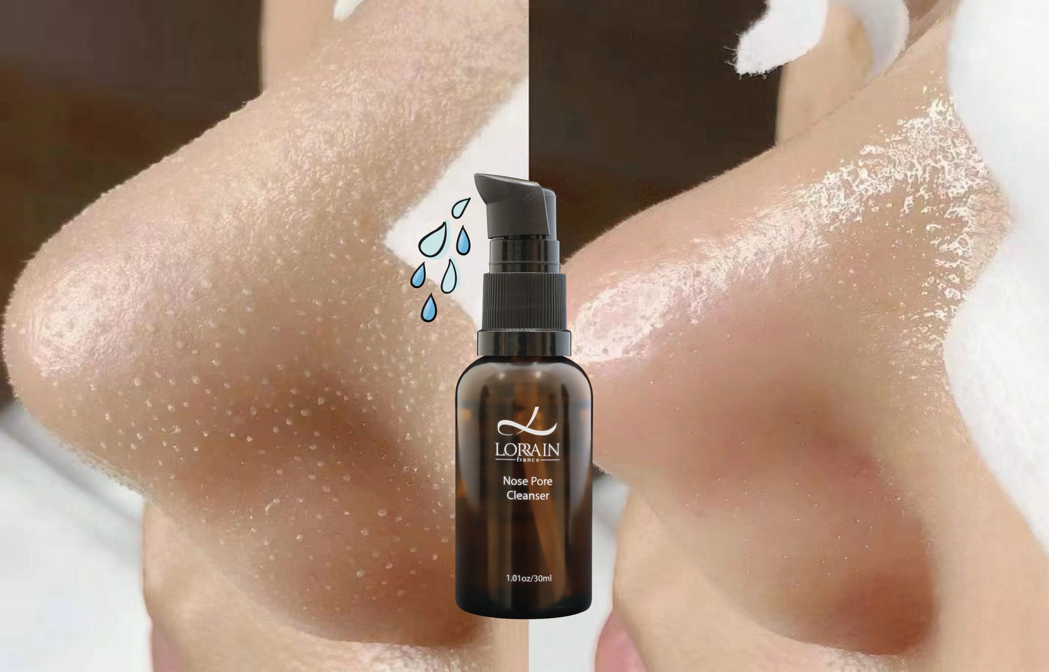 法國神奇迅速黑頭水 Nose Pore Cleanser