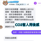 日本Co2 注氧碳酸一叮面膜
