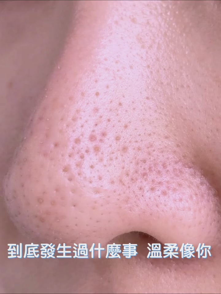 法國神奇迅速黑頭水 Nose Pore Cleanser